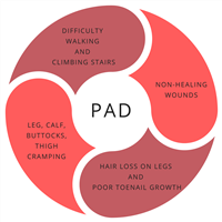 PAD Symptoms
