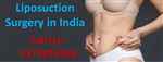 Top 10 Liposuction Surgery in India